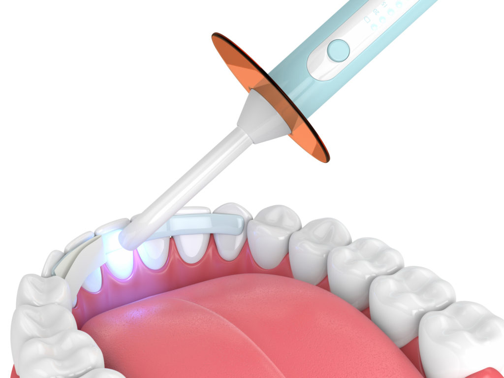 Periodontics Treatments from Dr. Pierre Dental May Help You Maintain Healthy Gums